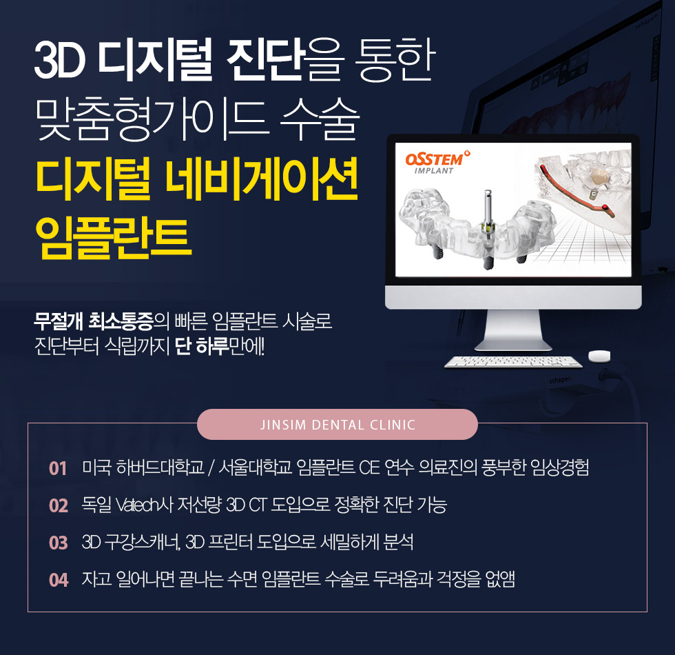 3D 디지털 진단을 통한 맞춤형가이드 수술 디지털 네비게이션 임플란트 